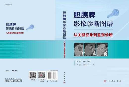 胆胰脾影像诊断图谱——从关键征象到鉴别诊断 商品图2