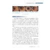 炎症性肠病疑难病例集（第一辑）/吴开春主编/浙江大学出版社 商品缩略图4