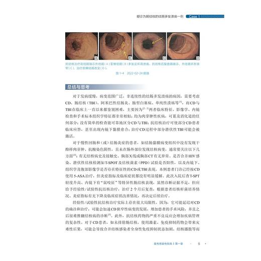 炎症性肠病疑难病例集（第一辑）/吴开春主编/浙江大学出版社 商品图4