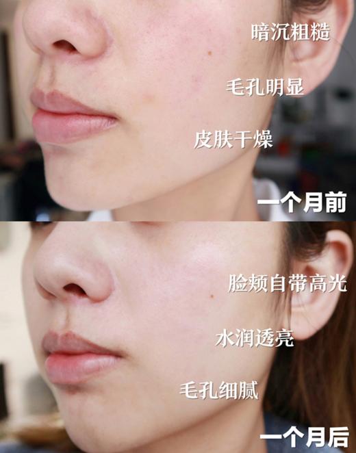 W后天Q丹水乳组合水乳组合韩国贵妇级护肤品 商品图7