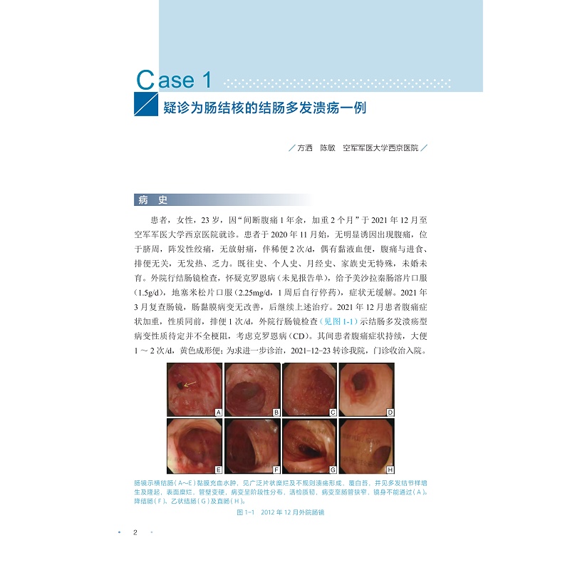 试读PDF-9787308256025(1-1)-炎症性肠病疑难病例集(第一辑)_012.jpg