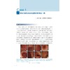 炎症性肠病疑难病例集（第一辑）/吴开春主编/浙江大学出版社 商品缩略图1