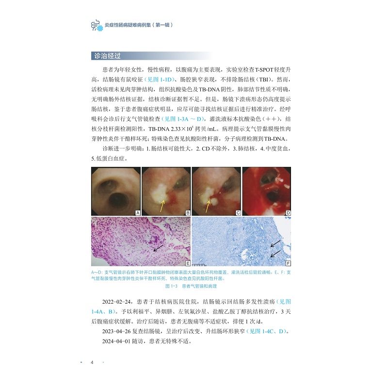 试读PDF-9787308256025(1-1)-炎症性肠病疑难病例集(第一辑)_014.jpg