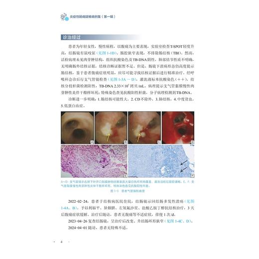 炎症性肠病疑难病例集（第一辑）/吴开春主编/浙江大学出版社 商品图3