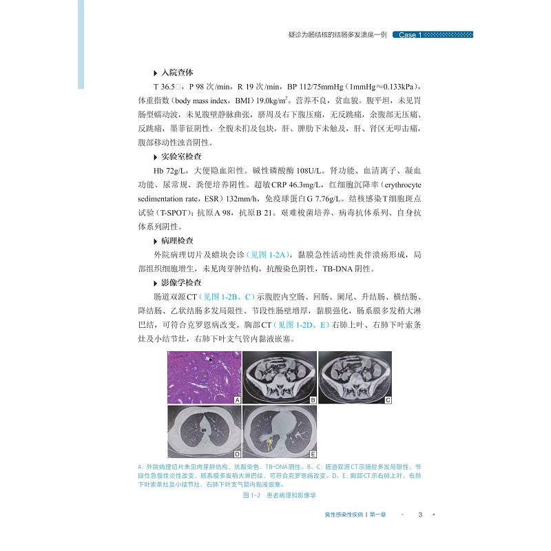 试读PDF-9787308256025(1-1)-炎症性肠病疑难病例集(第一辑)_013.jpg