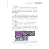 炎症性肠病疑难病例集（第一辑）/吴开春主编/浙江大学出版社 商品缩略图2