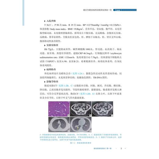 炎症性肠病疑难病例集（第一辑）/吴开春主编/浙江大学出版社 商品图2