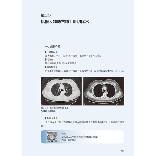 全孔道机器人辅助肺外科手术图谱 主编尤健 机器人辅助外科的建立条件 机器人辅助胸外科手术的麻醉9787117365635人民卫生出版社 商品图4