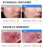 海龟爸爸双萃控油祛痘精华霜50g 商品缩略图2