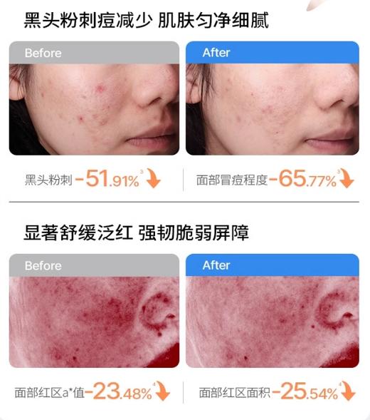 海龟爸爸双萃控油祛痘精华霜50g 商品图2