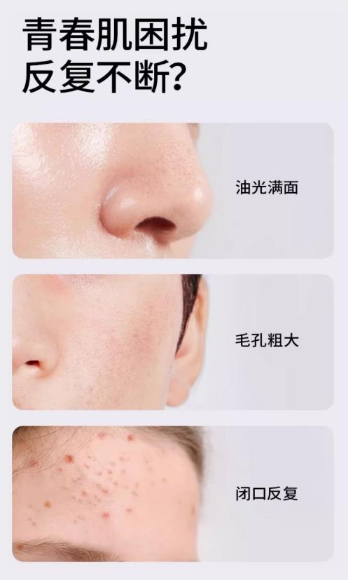 海龟爸爸双萃舒缓精华乳100ml 商品图1