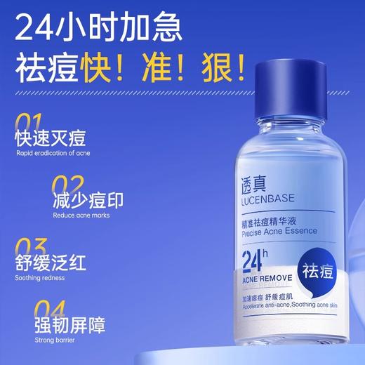 【油痘肌专研 祛痘快准狠】精准祛痘精华液 30ml#精准祛痘精华液水杨酸去黑头闭口粉刺修复舒缓淡印控油收毛孔 商品图1