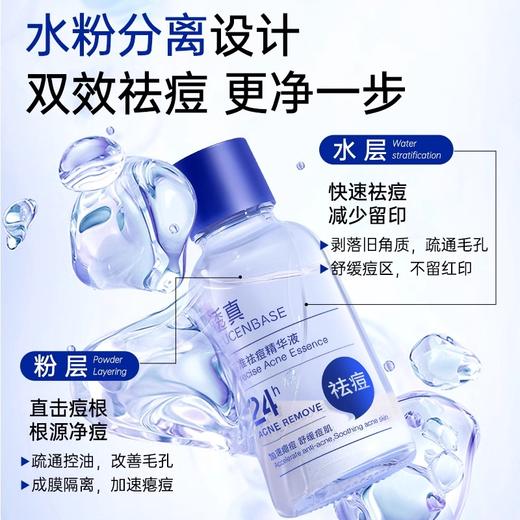 【油痘肌专研 祛痘快准狠】精准祛痘精华液 30ml#精准祛痘精华液水杨酸去黑头闭口粉刺修复舒缓淡印控油收毛孔 商品图2