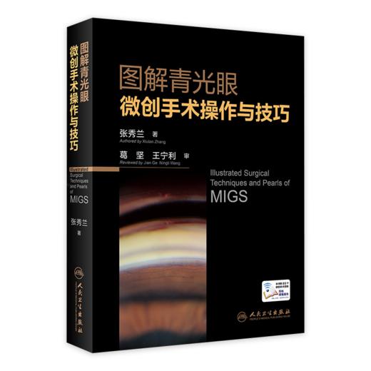图解青光眼微创手术操作与技巧 9787117332927 商品图0