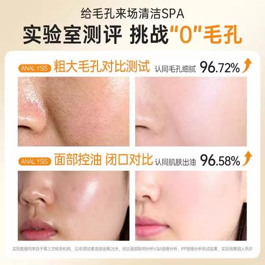 【天然舒缓 挑战0毛孔】金盏花舒缓控油爽肤水500ml#金盏花爽肤水秋冬补水保湿敷收缩毛孔控油去闭口护肤男女官方正品 商品图2