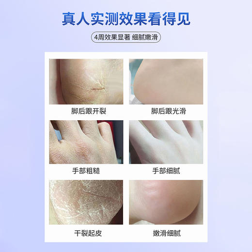 现货 俄罗斯进口 PANNAKISS普娜之吻防干裂膏50克/瓶   止痒修复 防冻防裂 商品图3