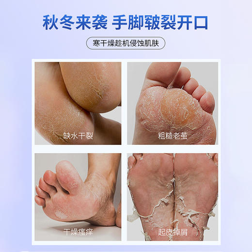 现货 俄罗斯进口 PANNAKISS普娜之吻防干裂膏50克/瓶   止痒修复 防冻防裂 商品图4