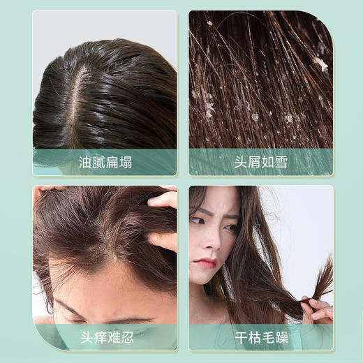 自营（菲小主）-控油蓬松净爽飘逸 经典清盈洗发水500ml 商品图6