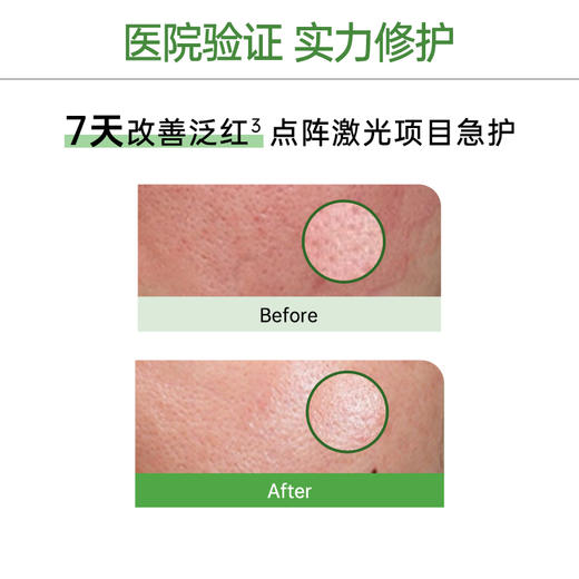 玉泽积雪草安心修护面膜敏感肌保湿修护屏障舒缓 商品图6