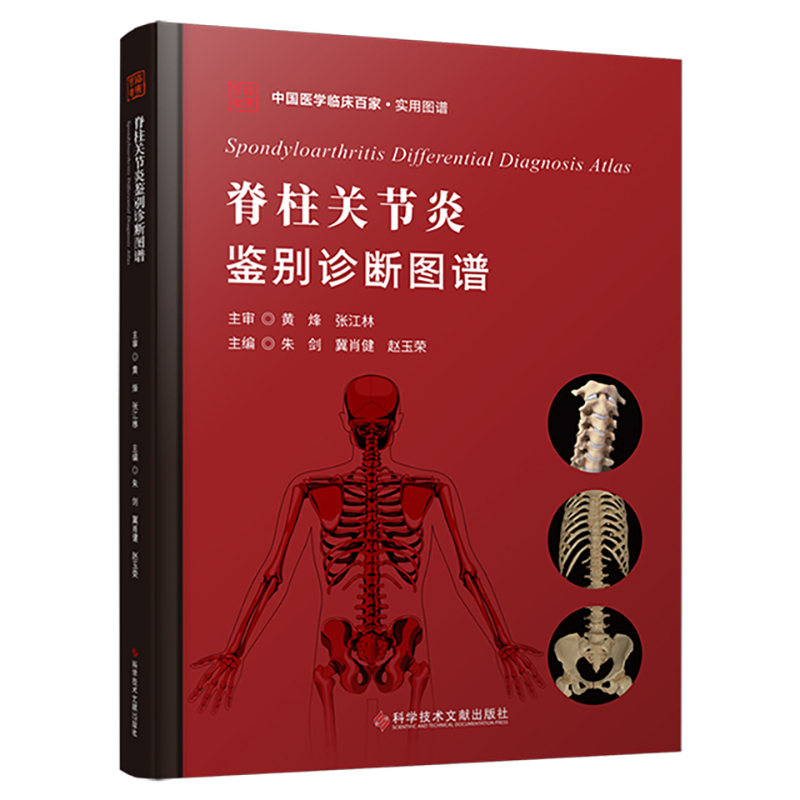 脊柱关节炎鉴别诊断图谱   主审  黄 烽 张江林  文献出版