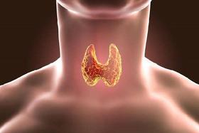 为什么女性高发结节？多半跟这3个因素有关......