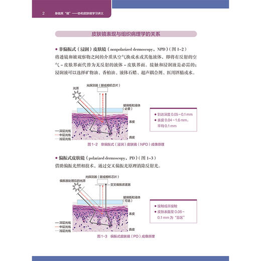 身临其镜 协和皮肤镜学习讲义 刘洁编著皮肤镜表现与组织病理学的关系 毛发疾病的皮肤镜诊断详解9787565932342北京大学医学出版社 商品图4