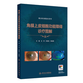 角膜上皮细胞功能障碍诊疗图解