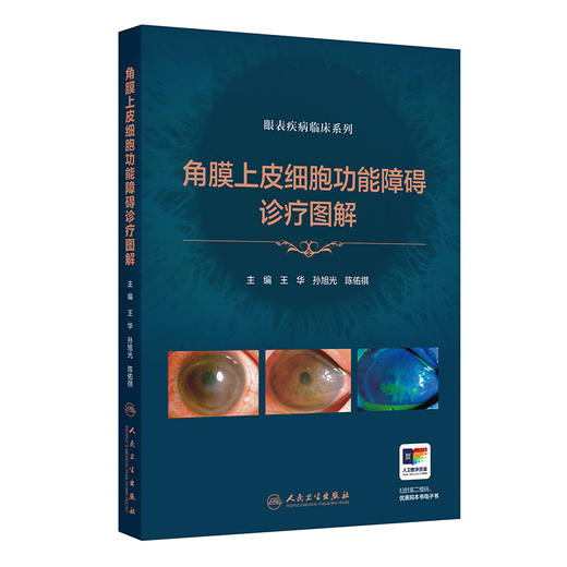 角膜上皮细胞功能障碍诊疗图解 商品图0