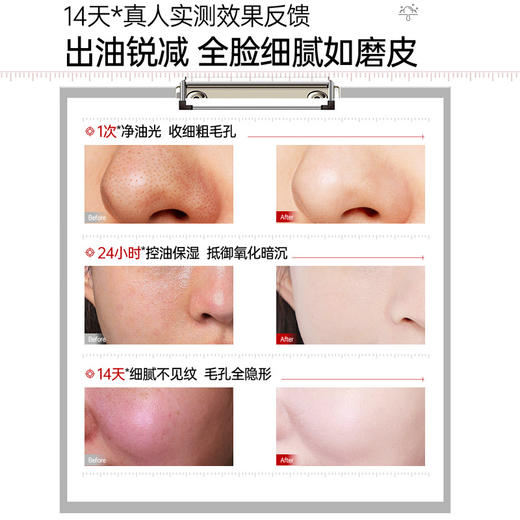 儒意控油细毛孔涂抹面膜100g  涂抹式面膜收缩毛孔控油清洁去黑头闭口粉刺|儒意官方商城 商品图4