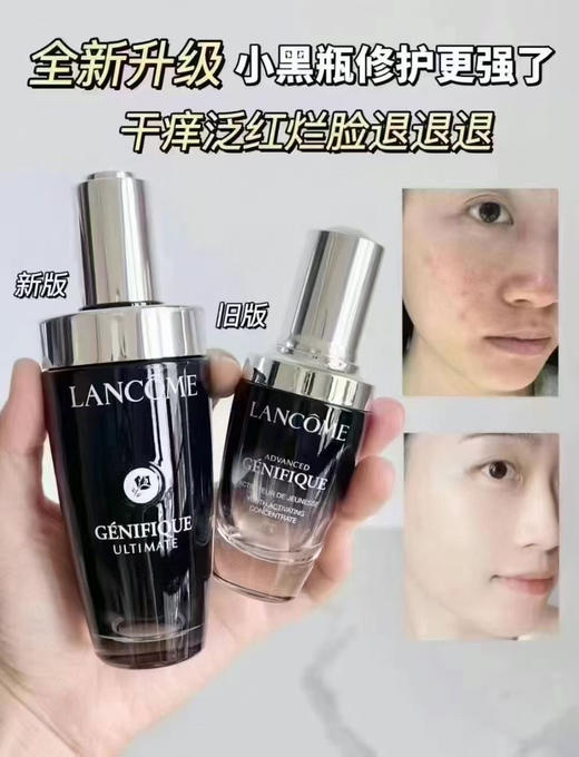 Lancome/兰蔻小黑瓶超修精华肌底三代 商品图3
