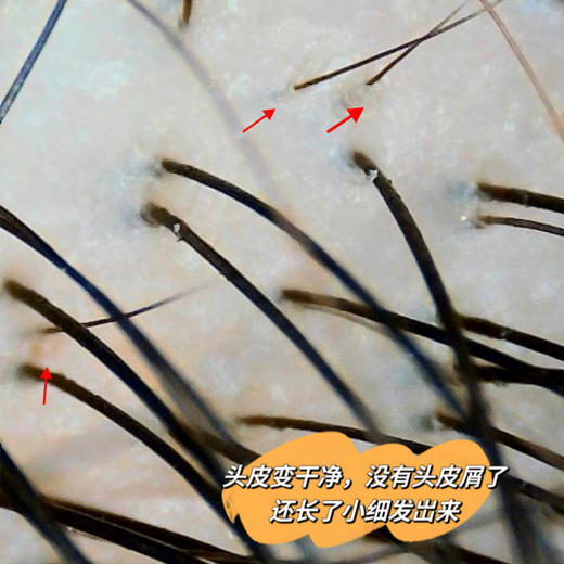 密思丝密防脱密发安瓶2盒装防脱育发精华 商品图2