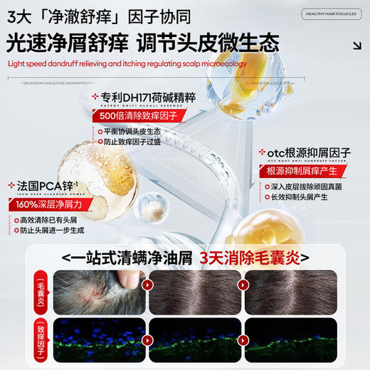 儒意二硫化硒去屑控油洗发水800g 毛囊清洁洗发水去屑止痒除螨控油蓬松炎洗头膏露品牌|儒意官方商城 商品图4