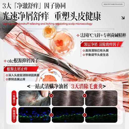 儒意二硫化硒去屑控油洗发水800g 毛囊清洁洗发水去屑止痒除螨控油蓬松炎洗头膏露品牌|儒意官方商城 商品图1