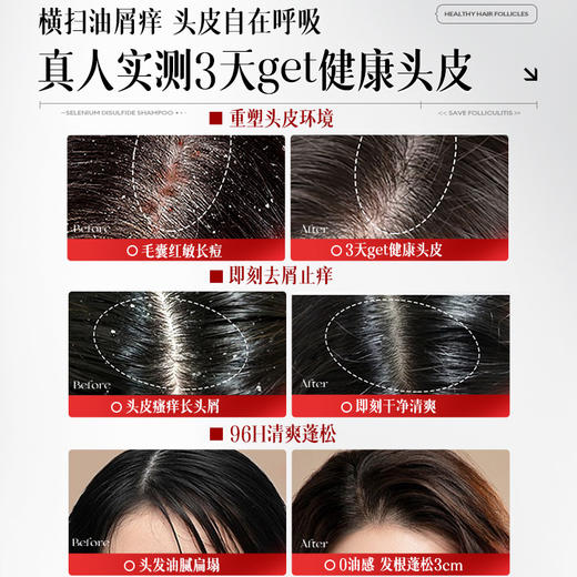 儒意二硫化硒去屑控油洗发水800g 毛囊清洁洗发水去屑止痒除螨控油蓬松炎洗头膏露品牌|儒意官方商城 商品图2