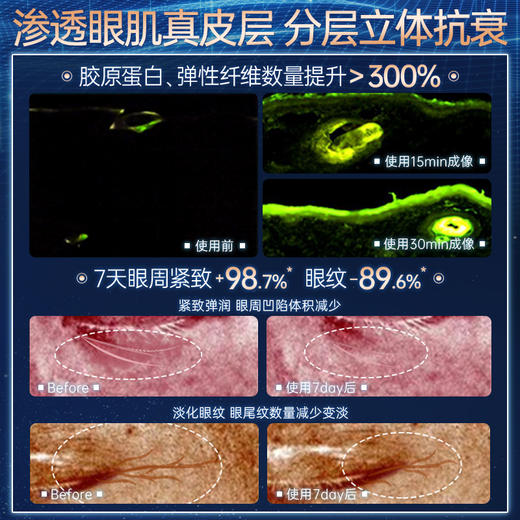 儒意凝时抗皱冻干眼膜套盒 抗老抗皱紧淡细纹眼纹黑眼圈眼部护理|儒意官方商城 商品图4