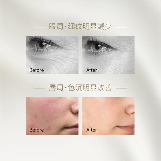 THREE 平衡重点保湿霜 20g 商品图4