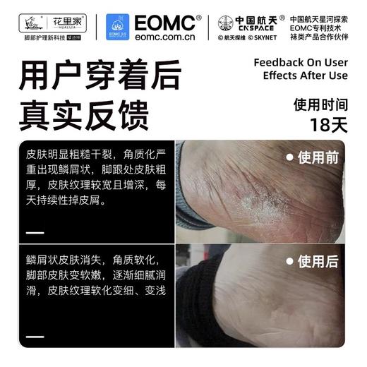 花里家红运礼盒长筒袜红色防臭精油袜男士商务中筒袜子纯色抗菌排汗透气秋冬季棉袜女 商品图3