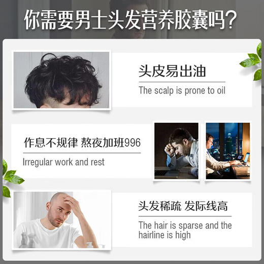 【保税仓】Swisse男士防脱发养发复合胶囊60粒  商品图1