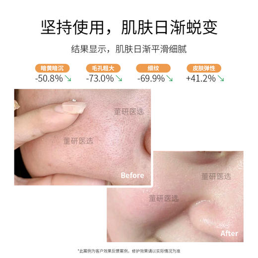 铂鱼铂金三文鱼水光精华 补水保湿 收缩毛孔 提亮肤色 修护屏障 直达肌底 正品防伪可查 商品图3