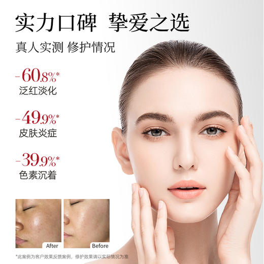 宝嘉茉红盒抗焱净痘长效精华 改善毛孔粗糙 改善水油平衡 净痘淡印 商品图4