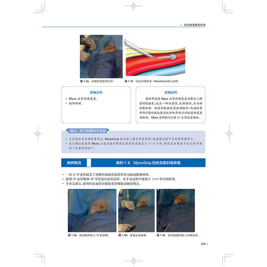 神经血管介入视频与图谱 徐斌译 神经外科神经内科介入放射科医师及其他从事神经介入和研究的工作者9787547869079上海科学技术出版社 商品图4
