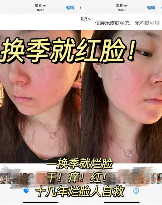 青春期 干敏肤 痘肤 油皮急救爽肤水EOLGUL维生素原B5保湿补水喷雾 商品图12