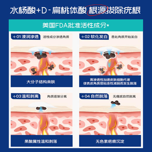 美国Breathy布雷辛 水杨酸雪松油膏 无痛消肉粒不留疤 商品图1