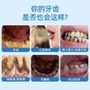 【世界体育冠军张婧代言】月儿弯弯PRO二代超声波洗牙器冲牙结石去除神器洁牙仪牙齿污垢除牙石家用 商品缩略图1