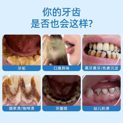 【世界体育冠军张婧代言】月儿弯弯PRO二代超声波洗牙器冲牙结石去除神器洁牙仪牙齿污垢除牙石家用 商品图1