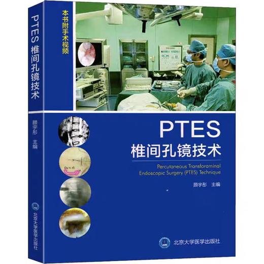 PTES椎间孔镜技术 商品图0
