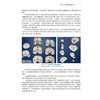 中枢神经系统退行性疾病临床神经病理学 王鲁宁等编 供从事神经科 老年科 精神科神经影像等专业的临床医师及相关基础研究人员参考 商品缩略图4