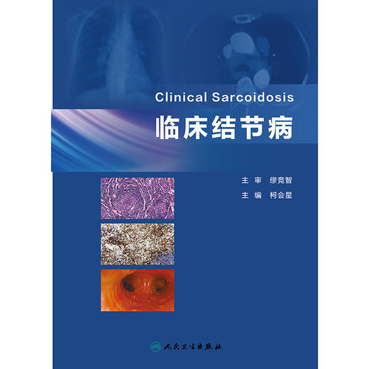 临床结节病 2024年12月参考书 商品图1