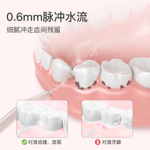 【马泷专属】通吃猫火箭猫冲牙器 商品图4