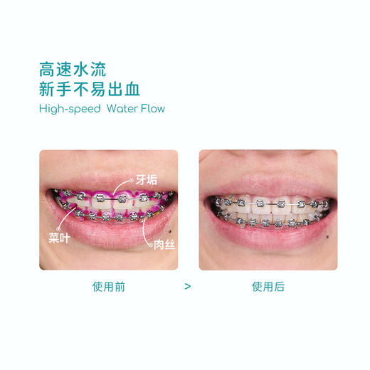 【马泷专属】通吃猫火箭猫冲牙器 商品图6